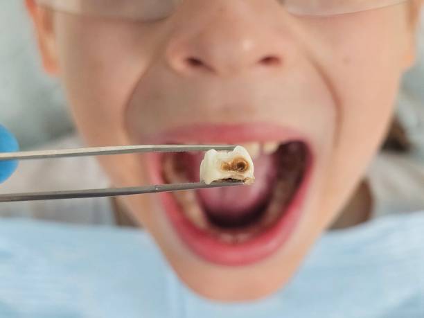 Best Emergency Pediatric Dentist  in Vista Santa Rosa, CA